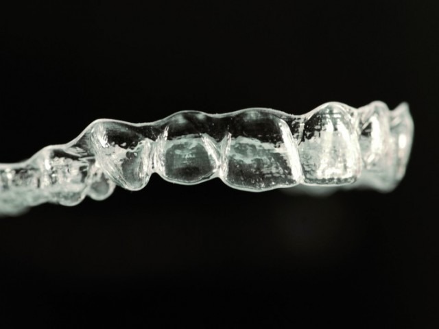 ALIGNERS